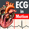 ECGinMotion