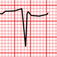 ECG