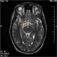 BodyScans