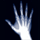 XrayScanner